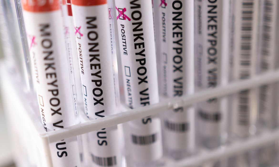Brasil busca por vacinas contra monkeypox