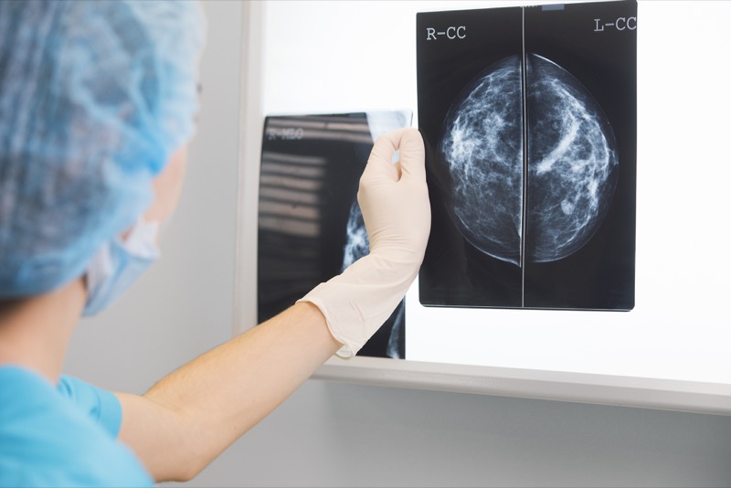 Mamografias atingem novas faixas etárias